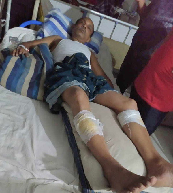 আগৈলঝাড়ায় মন্ত্রীপুত্রসহ বিএনপির ৬নেতাকর্মী আহত