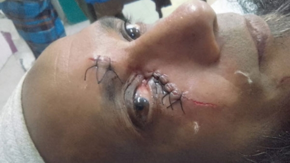 আমতলীতে প্রবাসীকে কুপিয়ে জখম
