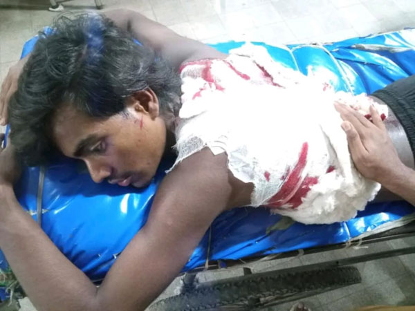 দুমকিতে পূর্বশত্রুতায় কিশোরকে কুপিয়ে জখম!