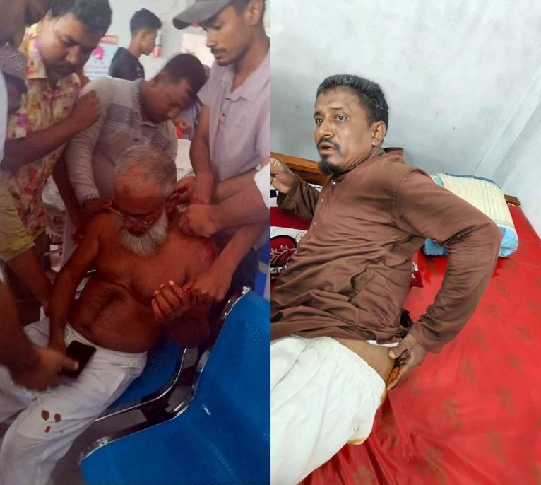 চরফ্যাশনে সাবেক ইউপি চেয়ারম্যানসহ দুই জনকে কুপিয়ে জখম