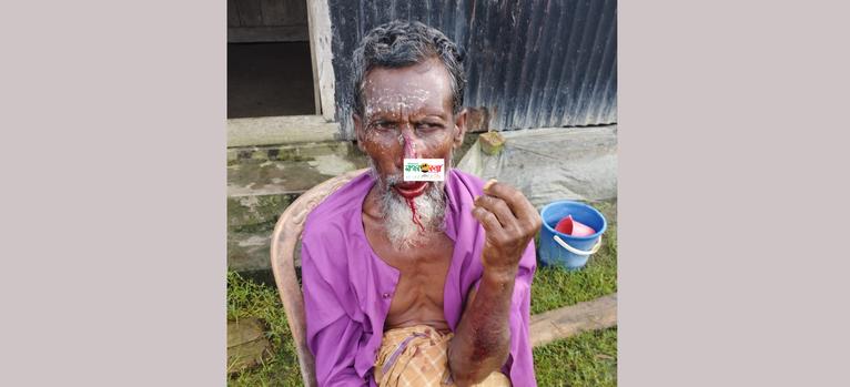 তালতলীতে প্রতিবাদ করায় বৃদ্ধ চাচাকে পিটিয়ে জখম