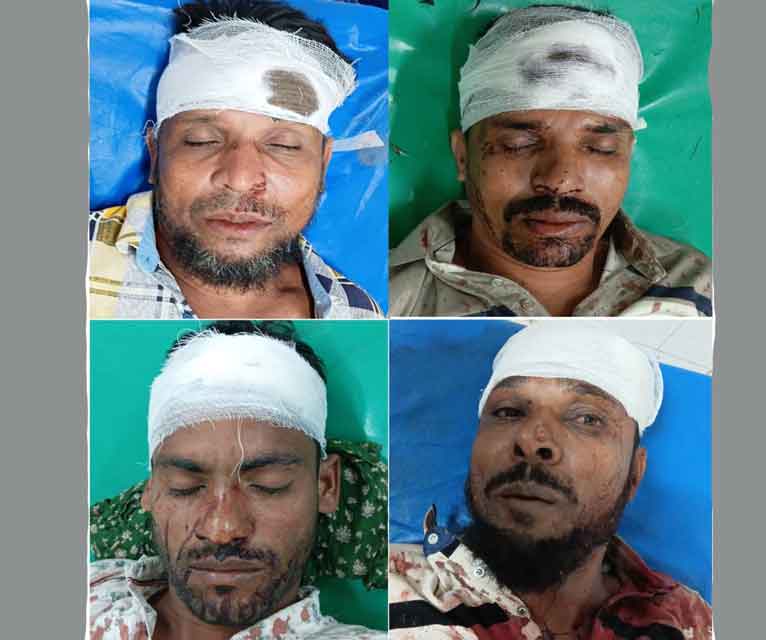 দুই শিশুর ঝগড়ায় একই পরিবারের চারজন আহত