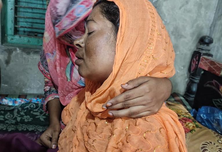 কুয়াকাটায় মৃত্যুর সঙ্গে লড়ছে নুরজাহান