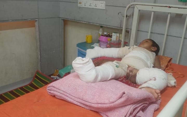 রামপালে গরম পানিতে পড়ে দগ্ধ শিশু