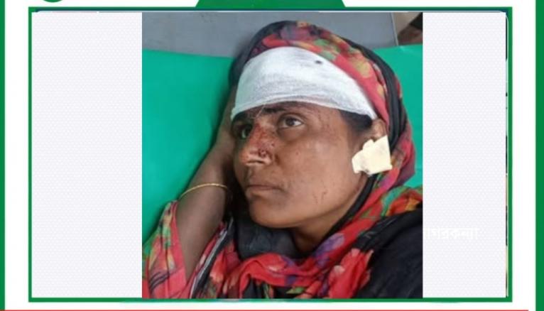 ধানের শীষের ভোট না চাওয়ায়  চরফ্যাশনে নারীর মাথা ফাটানোর অভিযোগ যুবদল নেতার বিরুদ্ধে