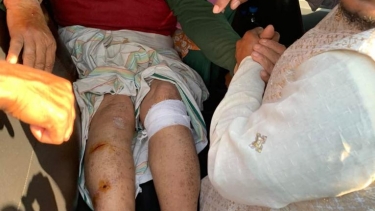 বরগুনার পাথরঘাটায় সাবেক এমপিকে পিটিয়ে গুরুতর আহত