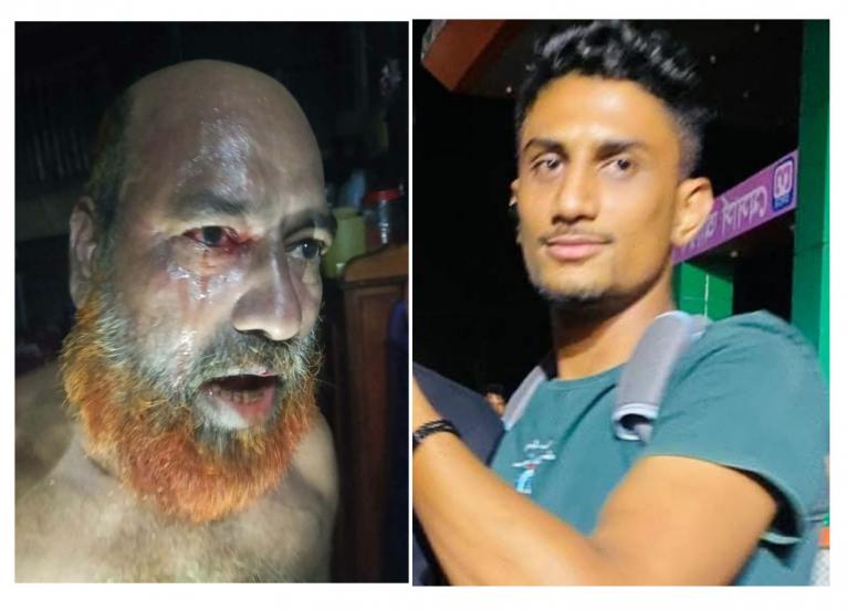 গৌরনদীতে গৃহকর্তাকে মারধর করে পালাল চোর, আহত-১