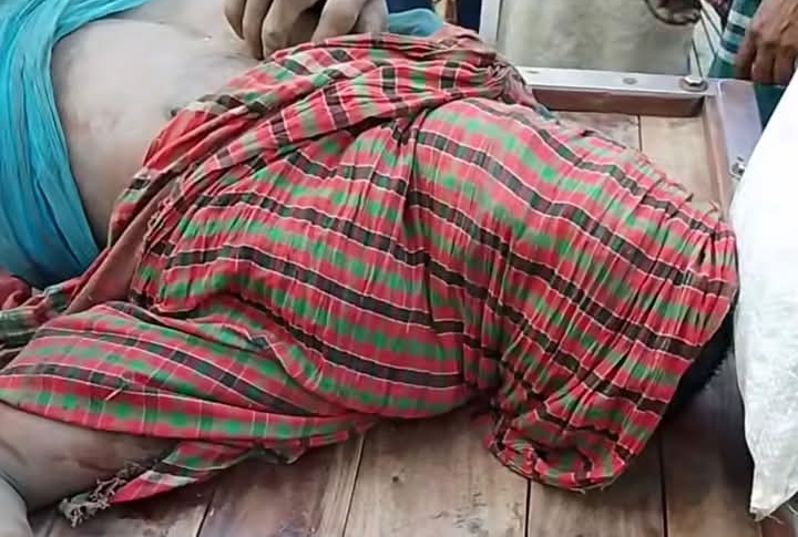 মোল্লাহাটের মাছ চুরির অভিযোগে যুবকের দু’চোখ উপড়ে ফেলল জনতা