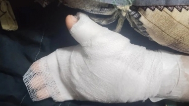 তালতলীতে জমি বিরোধে নারীকে পিটিয়ে হাত ভাঙার অভিযোগ