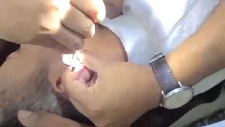 কানের ভেতর লুকানো ইয়াবা, ৯ দিন পর অস্ত্রোপচারে উদ্ধার