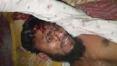 চরফ্যাশনে কুপিয়ে হত্যাচেষ্টা, গুরুতর আহত যুবক হাসপাতালে