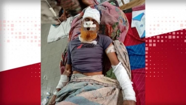 চরফ্যাশনে আ:লীগের চেয়ারম্যানকে শেল্টার দেওয়ার দ্বন্দ্ব: বাবা-ছেলেকে কুপিয়ে হত্যাচেষ্টার অভিযোগ