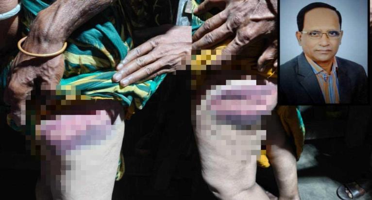 মির্জাগঞ্জে বিরোধ মেটাতে গিয়ে বিএনপি নেতার বিরুদ্ধে তিনজনকে নির্যাতনের অভিযোগ