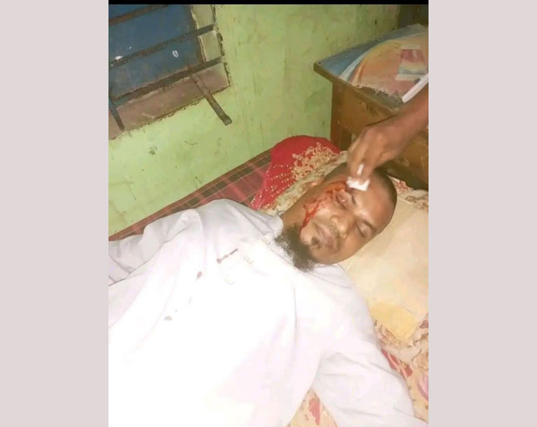 চরফ্যাশনে যুবদল নেতার বিরুদ্ধে জামায়াত কর্মীদের নির্যাতনের অভিযোগ