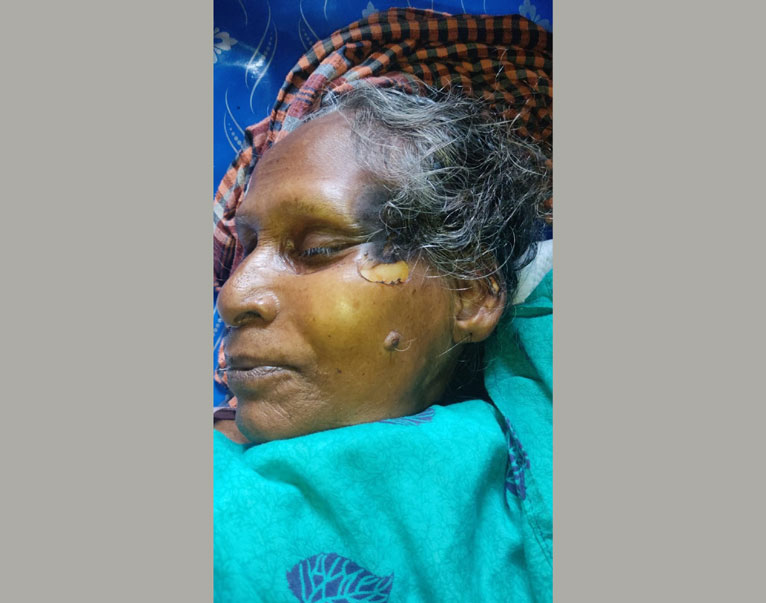 টুঙ্গিপাড়ায় ইজিবাইকের চার্জার লাইনে বিদ্যুৎস্পৃষ্ট হয়ে বৃদ্ধার মৃত্যু