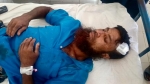 কলাপাড়ায় মাছ ধরাকে কেন্দ্র করে সংঘর্ষে এক ব্যক্তি আহত