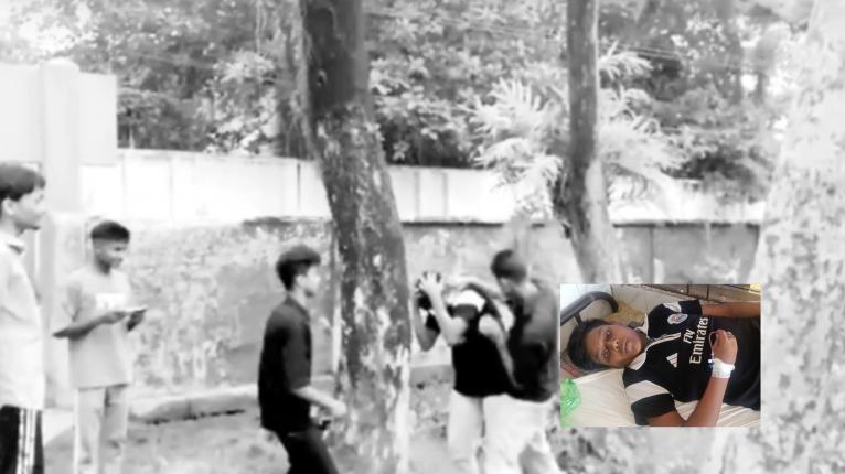 কলাপাড়ায় কিশোর গ্যাংয়ের হামলায় এসএসসি পরীক্ষার্থী আহত, ভিডিও ভাইরাল