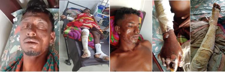চরফ্যাশনে মাছধরা ট্রলারে গ্যাস সিলিন্ডার বিস্ফোরণ, দগ্ধ ৫