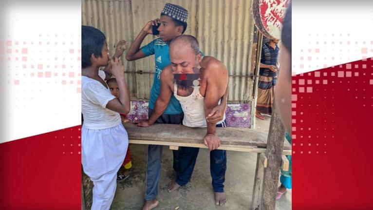 মহিপুরে ছোট ভাইয়ের নাক ফাটানোর অভিযোগ যুবদল নেতার বিরুদ্ধে