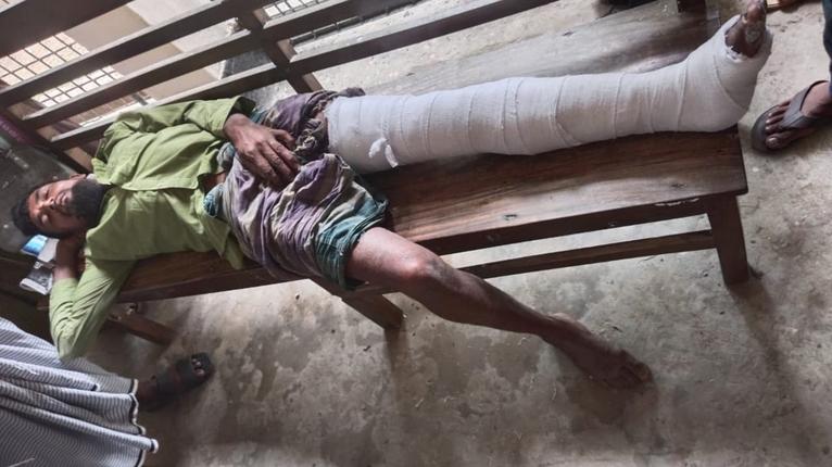 গলাচিপায় প্রতিবন্ধীকে মারধর, হাসপাতালে ভর্তি