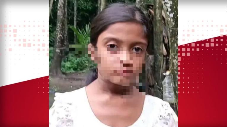 মঠবাড়িয়ায় স্কুলছাত্রীকে গরম খুনতির ছ্যাঁকা দেওয়ার অভিযোগ, অভিযুক্ত সৎ মা