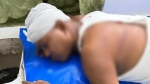 গৌরনদীতে সাবেক কাউন্সিলরকে মারধরের অভিযোগ, হাসপাতালে ভর্তি