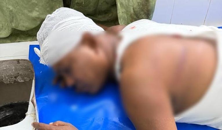 গৌরনদীতে সাবেক কাউন্সিলরকে মারধরের অভিযোগ, হাসপাতালে ভর্তি