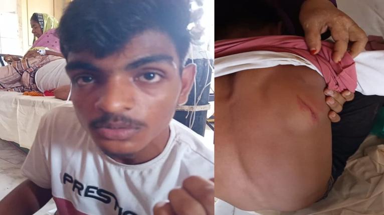 আর্জেন্টিনা সমর্থক স্কুলছাত্রের ওপর হামলার অভিযোগ, হাসপাতালে ভর্তি