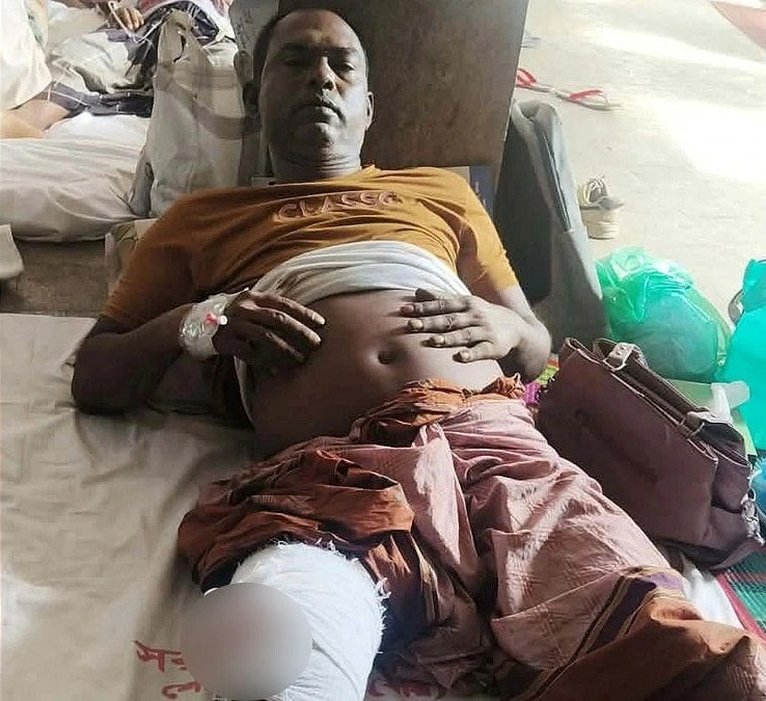 চিকিৎসাধীন আইনজীবী সামিউল আলম মল্লিক