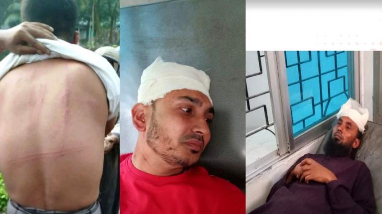 মনপুরায় মসজিদ থেকে ডেকে নিয়ে শিক্ষক ও স্বাস্থ্যকর্মীকে পিটিয়ে রক্তাক্ত করার অভিযোগ